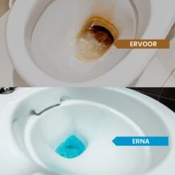 Needum ® Toiletblokjes Voor Inbouwreservoirs – WC-blokjes – Toiletblokken In Een Voordeelverpakking – 30 Stuks 12 Needum ® Toiletblokjes Voor Inbouwreservoirs – WC-blokjes – Toiletblokken In Een Voordeelverpakking – 30 Stuks -Schoonmaakmiddelen 1200x1200 384