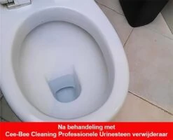 Urinesteen Pakket - Voor Het Verwijderen Van Urinesteen En Het Voorkomen Van Urinesteen - 1x Urinesteenoplosser - 2x Toiletreiniger -Schoonmaakmiddelen 1200x971